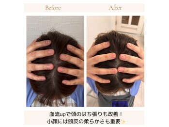 ソルビーフェイス(SOL*BeFace)/頭のはち張りにも!