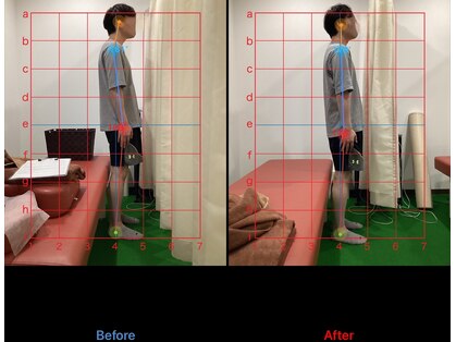 おぜき接骨院 整体院 大垣の写真