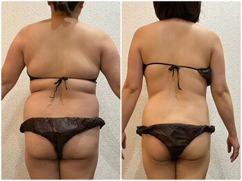 美容整体ウェリナ あま甚目寺院/小顔矯正/骨盤矯正/美脚サロン