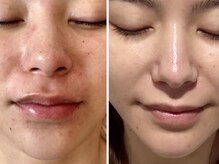 ペリドット(Peridot)