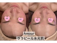 アムール(Amour)/ララピール水光肌