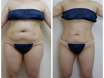サロン総美の写真/【倉敷でここだけ！】最高峰の痩身マシン2台完備！◎40代の頑固な深部脂肪を狙い撃ちする本気痩身！
