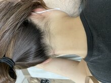 ナノハナ/鹿沼市の全身脱毛美容室ナノハナ