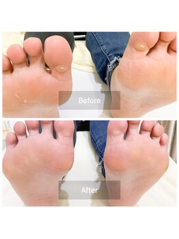 フリージア(Freesia)/魚の目も綺麗に☆