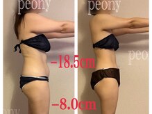 ピオニー(PEONY)/【痩身】全身まるごと脂肪燃焼