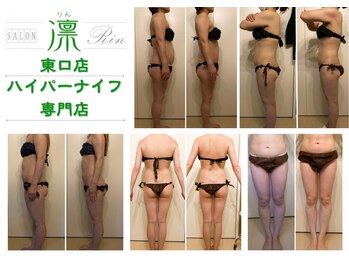 エステサロン 凛の写真/ボディ１番人気!春の全身速攻やせ!!【全身ハイパーナイフ&カッサ合計100分¥14800】目指せ3ヶ月で目標達成♪