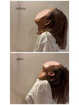 ビーメイク(Be make)/施術before &after