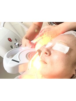 シミしわ改善！予防ケア