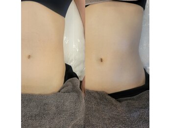 ネイルズビー 別邸(Nail's be)/腸揉み