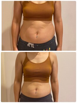 エステティックサロン ピュール ボーテ 東金店/ＢＳＰダイエット