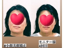 ラクーラビューティー(Lacu-ra Beauty)の雰囲気(小顔美顔矯正)