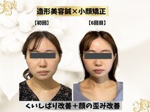 エモシオン トウキョウ(EMOTION TOKYO)/造形フェイス