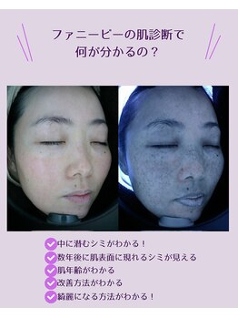 ファニービー 高槻店/肌診断1