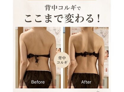 コルギサロン ヴィサンテ(Visante)の写真