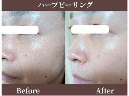 ココロ(COCORO)の写真