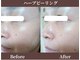 ココロ(COCORO)の写真