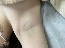 ナノハナ/鹿沼市の全身脱毛美容室ナノハナ