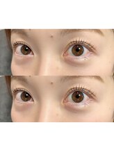 ルー(Lou)/ラッシュリフト