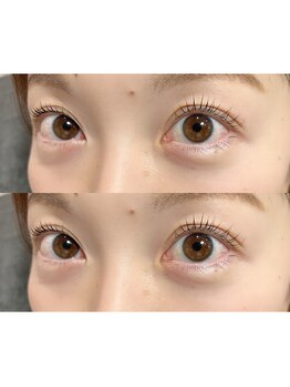 ルー(Lou)/ラッシュリフト