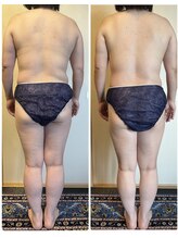 ローズ 下松(ROSE)/【筋膜リリース150分】