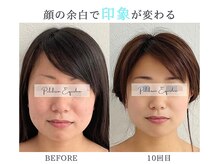 プルチャームエクイデム(Pulchram equidem)/ララピール+エレポレ+ヒト幹細胞