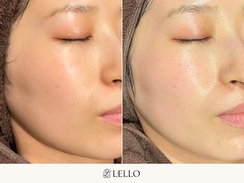 レロ 恵比寿店(LELLO)/透明感溢れる明るい印象の肌に