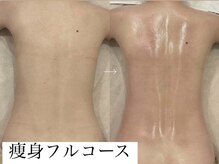 サンオーラ(SUN AURA)/背中美人目指しましょう！