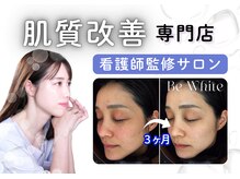 ビーホワイト(BeWhite)