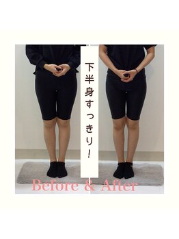 スタイルラボ高松/産後の骨盤矯正の効果♪