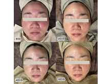 ダリア(Dahlia)の雰囲気(人気施術【50代・60代編】ぷるんと弾む肌♪ふっくら潤い肌★)