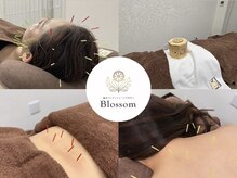 ブロッサム(Blossom)