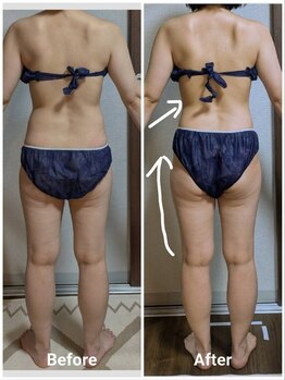 エテルノ(eterno)/下半身集中コースでヒップアップ