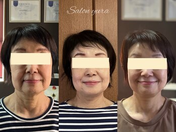 シア スパ(SIA SPA)/小顔コルギビフォアフター