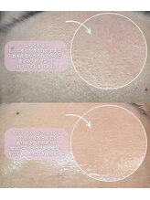 リ クリニカル ラボ(Re clinical Labo)/毛穴、黒ずみ、くすみケア