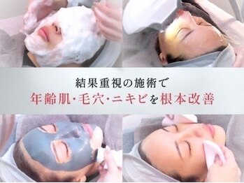 サリエ(S'allier)/極上の肌ケア、毛穴ケア!!