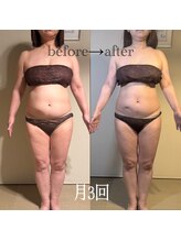 アモリール 京都北大路(Amolir)/全身しっかり120分で本気痩せ!!