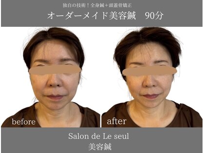 ルソール(Le seul)の写真