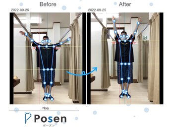 Noa接骨院 はりきゅう院/肩の痛み・可動域制限