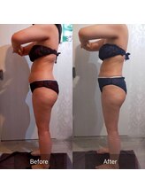 ビルーチェ(BELUCE)/ハイパーリボーン