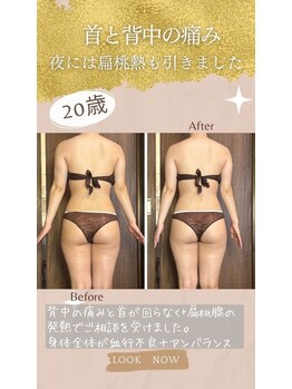 アーユルヴェーダアンドアロマエステ アユス(AYUS)/【20代】アーユルヴェーダリンパ