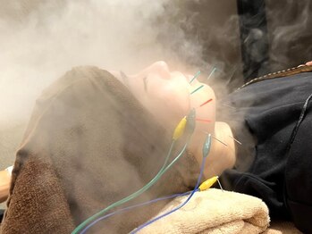 森の鍼灸院 京都下京町家院の写真/【大人気美容鍼が京都に☆】他店では改善出来なかったお身体を当店で見極め解決へと導きます!