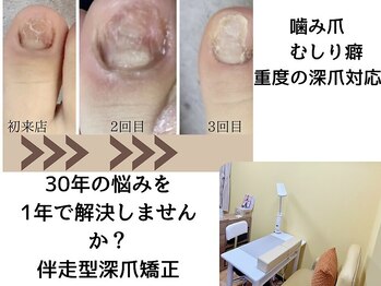 グレースレディ/長年のお悩み解決しましょう