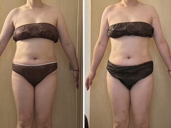 マイティー整骨院 ココア(CoCoa)/セルクラ