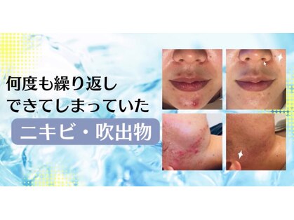 美プラスの写真