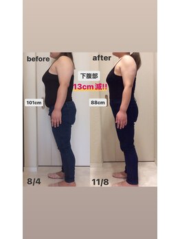 ホロニック ベルサンテ(Holonic Belle Sante)/メディセルハイブリッド