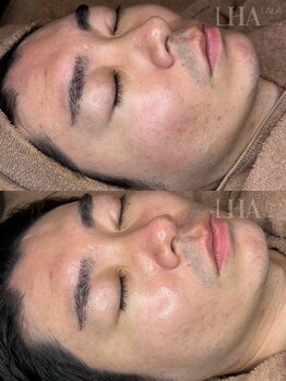 ピュアソル 枚方店(Puresol)/