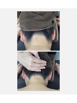 ミース 仙台長町店/うなじ●ビフォーアフター