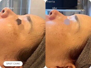 キュレイテッドスキン(CURATED SKIN)/