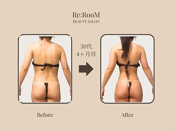 リ ルーム(Re:RooM)/痩身Before&After