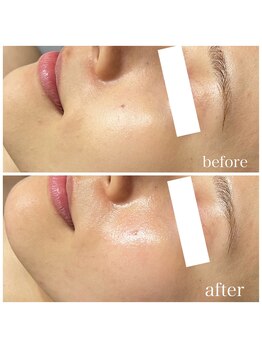 ナーズ(NAZ)/MIRROR ピール